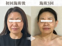 メイヴィ 四日市(Maivi)の雰囲気(【60代女性3回の変化!】四日市 リフトアップ/四日市 たるみ)