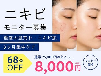 サロン ド セイ(Salon de SEI)の写真/モニター先着順　韓国で予約半年待ち「トロイアルケ」25000円→8000 ニキビを繰り返さない肌育成