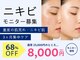 サロン ド セイ(Salon de SEI)の写真/モニター先着順　韓国で予約半年待ち「トロイアルケ」25000円→8000 ニキビを繰り返さない肌育成