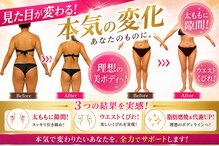 ソエルテ(soerute)