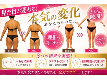ソエルテ(soerute)の写真