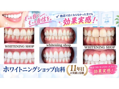 ホワイトニングショップ 山科店の写真