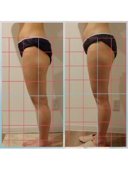 リノ(lino)/骨盤矯正+筋膜リリースで立ち姿