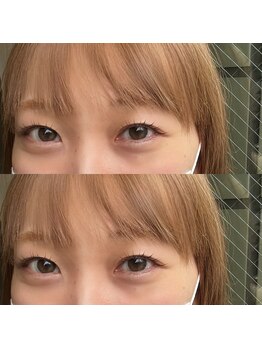 エニュ(anew)/Lashlift