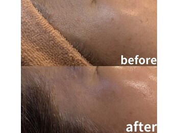 エステティック ボア(ESTHETIQUE BOITE)/