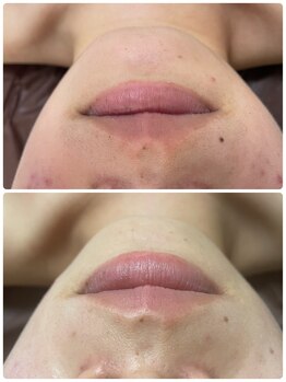 ビューティーホームサロン(Beauty Home Salon)/顔脱毛