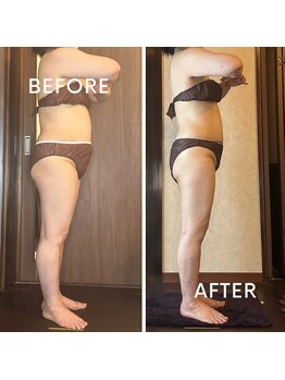 アーユルヴェーダアンドアロマエステ アユス(AYUS)/【50代】痩身初回⇒6回目