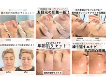 ギフト(gift)の雰囲気（効果実感◎リピーター様多数★驚きのビフォアフはブログを！）