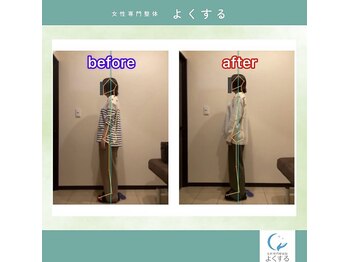 よくする 新潟市/お客様ビフォーアフター