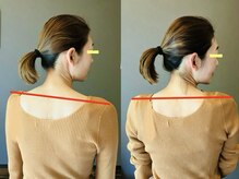 香音堂(カノンドウ)/【首/肩こり】の改善