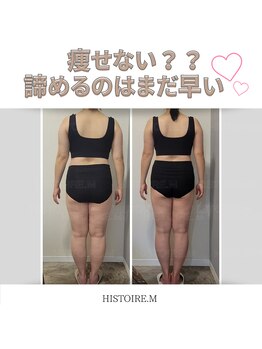 イストアールエム(HISTOIRE.M)/筋膜リリースダイエットコース