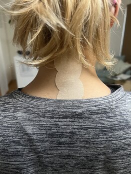 メル(MeRu)/クラウドテープを使った施術(2)