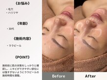 ルディラ 恵比寿店/ララピール