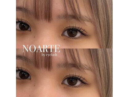 ノアート(NOARTE)の写真