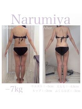 トータルチェンジエステ ナルミヤ(total change esthe Narumiya)の写真/熟練手技でしっかりリンパを流して代謝もUP!プロ視点からの的確なアドバイスも嬉しい◎