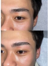 グレーシェル 天神大名店(Gracher)/HBL Before→After