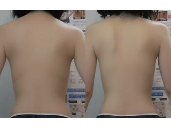 ソラナ (Solana)/ビフォーアフター