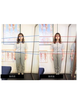 ボディラインを整えたい