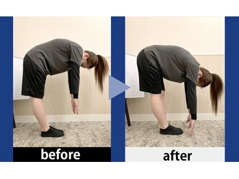 理学ゼーション 天王店/ビフォーアフター