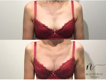 エヌドット 日本橋(N.)/谷間をくっきりバストケア☆