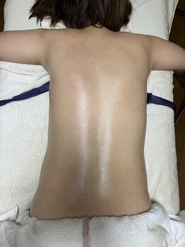 アンフィニ 尼崎店(Anfini)/お背中左側を整えました!