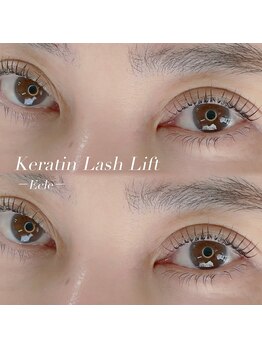 エクレ(Ecle)/マツパ◎ケラチンラッシュリフト