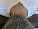 ハルシオンの写真/首肩コリの悩みに◎10年以上の経験を持つ鍼灸師が深部の筋肉にアプローチ！施術後のスッキリ感に感動を！