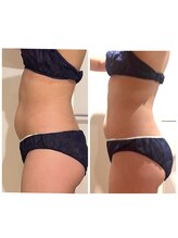 パルティール 恵比寿店(partir)/くびれ美人に大変身♪