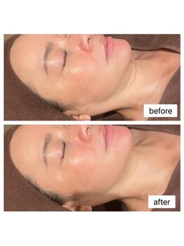 トータルクリア(TOTAL CLEAR)/レモンボトル・RED SHOT