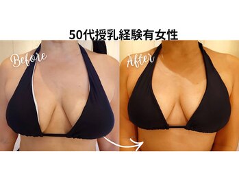 サロンハナ(Salon HANA)/50代授乳経験2人のお客様