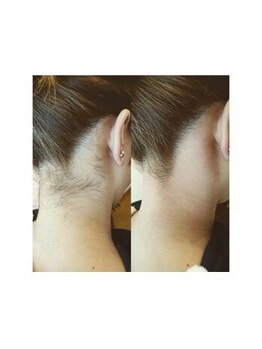 アネラサロン(Anela salon)/うなじワックス