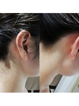 RiとBiのたまご/(ブライダルエステ)　１DAY集中