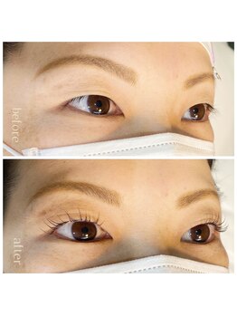 エムアンド(m&)/コスメリフト