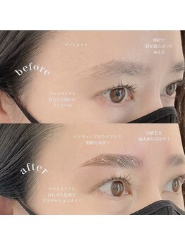 ディスイズ(thisis)/ハリウッドブロウリフト