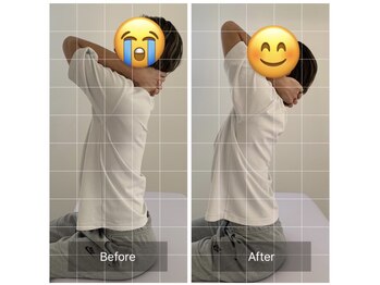 ナオル整体 恵比寿院(NAORU整体)/恵比寿/整体事例【胸椎伸展】