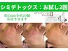 夏でもできる！【約20個を狙える低周波シミケア】（2回分）通常￥14,000→