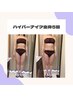 人気No4【代謝UP＆脂肪燃焼&引き締め】全身まるごとケア★ハイパーナイフ90分