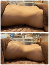 ヨロ(YOLO)/YOLO式腸もみ