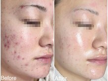 ラブリボン/短期プログラム