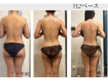 オーシャンブルーム 目黒(OceanBloom)/ブライダル痩身