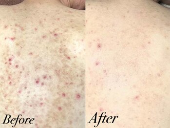 リララ 江坂店(Lelala)/★ビフォーアフター!