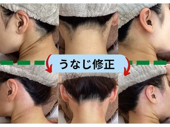 ディスイズミー シュガーリング(This is me Sugaring)/【シュガー】うなじ脱毛