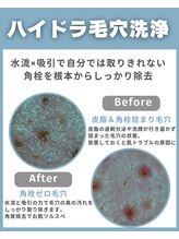 BUB 立川/毛穴引き締め効果大 &nbsp;美白効果大