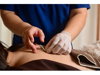 ルポ 那覇(repos)の写真/【その不調、放置しないで！】状態に合わせたオーダーメイド施術で根本改善★ご妊娠中の方も対応◎