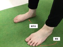ビオプラス そごう大宮店(bioplus)/お悩みはの症状をヒアリング