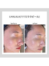 ポムハヌル(pom.haneul)/韓国肌管理室