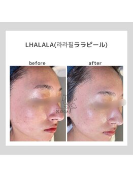 ポムハヌル(pom.haneul)/韓国肌管理室