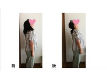 ヌフヌフ(neuf neuf)/首・肩こりの方に届けたい施術