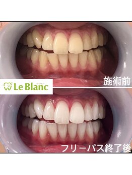 ルブラン 奈良店(Le Blanc)/お肌も明るく見える