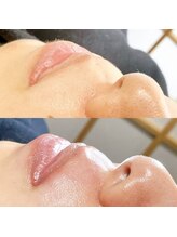 エミュ(emu)/フェイシャルwax